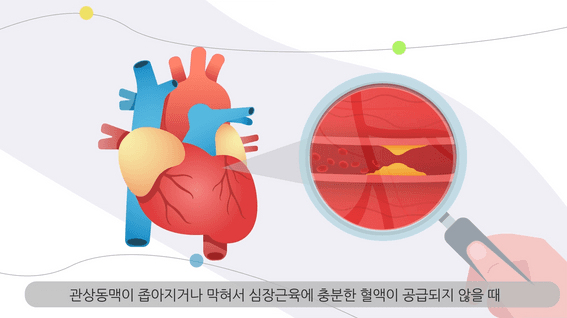 두둠 포트폴리오 - 대학병원 심장질환 설명영상