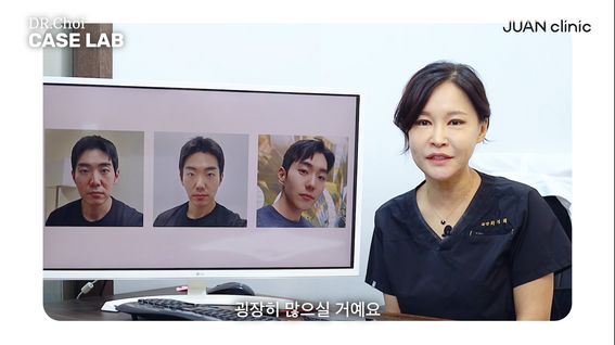 두둠 포트폴리오 - 주앤클리닉 시술 케이스리뷰 영상 | 잡티, 색소침착 편